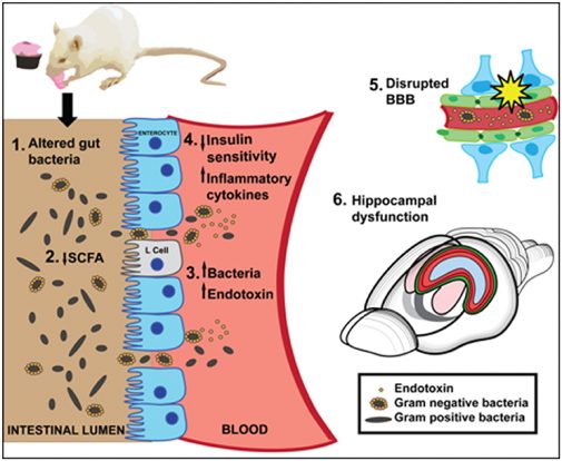 Asse Intestino-cervello: Memoria A Rischio Se La Dieta è Scorretta