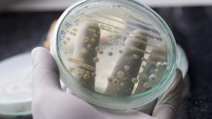 Micobiota: funghi su piastra petri