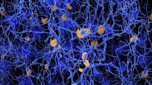 Probiotici che producono SCFA potrebbero contrastare l’Alzheimer