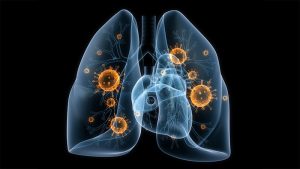 Infezioni polmonari: il microbiota intestinale sarebbe in grado di proteggere dai patogeni