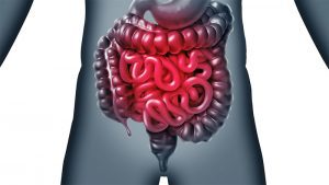Morbo di Crohn: possibile ruolo dell’ureasi prodotta dal microbiota