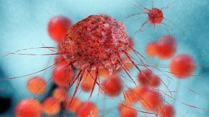 Trapianto fecale e probiotico aumentano efficacia di immunoterapie anti PD-1