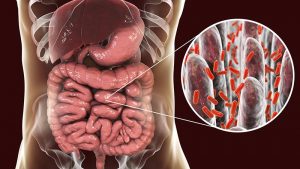 Microbiota intestinale coinvolto in sindrome metabolica