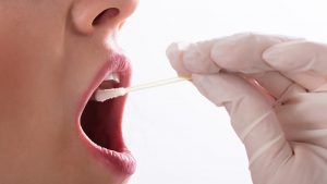 Tampone saliva microbioma orale