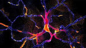 Neuroni sclerosi multipla