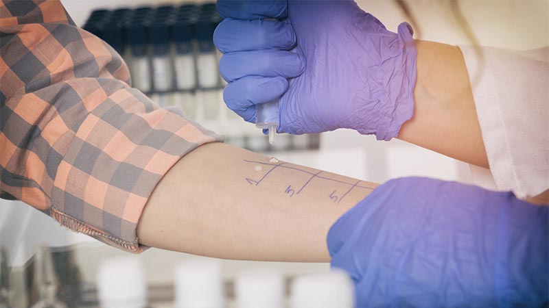 Allergie e intolleranze alimentari: dai batteri intestinali nuove prospettive di cura Test allergia e intolleranza: il microbiota intestinale ha un ruolo