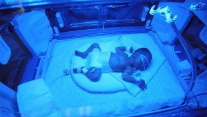 Ittero neonato e microbiota
