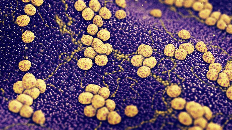 Infezioni Da Stafilococco Aureo Probiotico Bacillus Ostacola Colonizzazione [ 450 x 800 Pixel ]