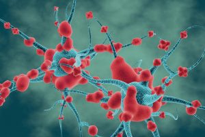 Neuroni sclerosi multipla e microbiota