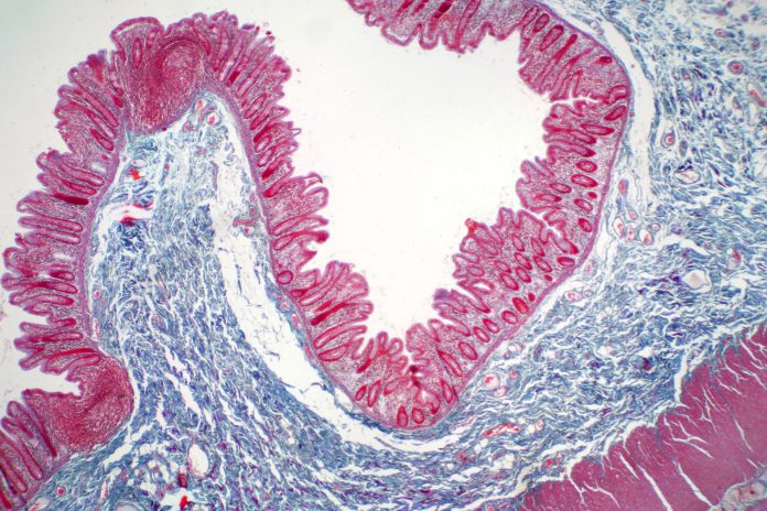 Traslocazione batterica intestinale: studio rivela ruolo dei recettori per la lectina Traslocazione batterica intestinale: studio rivela ruolo dei recettori per la lectina
