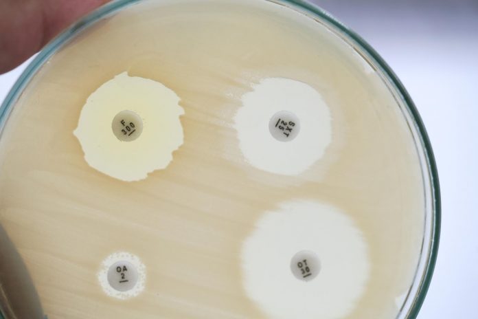 Microbiota intestinale: punto di partenza per affrontare l’antibioticoresistenza? Microbiota intestinale: punto di partenza per affrontare l’antibioticoresistenza?
