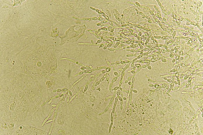 Agire sui lieviti intestinali: nuovo possibile approccio terapeutico per le IBD Agire sui lieviti intestinali: nuovo possibile approccio terapeutico per le IBD