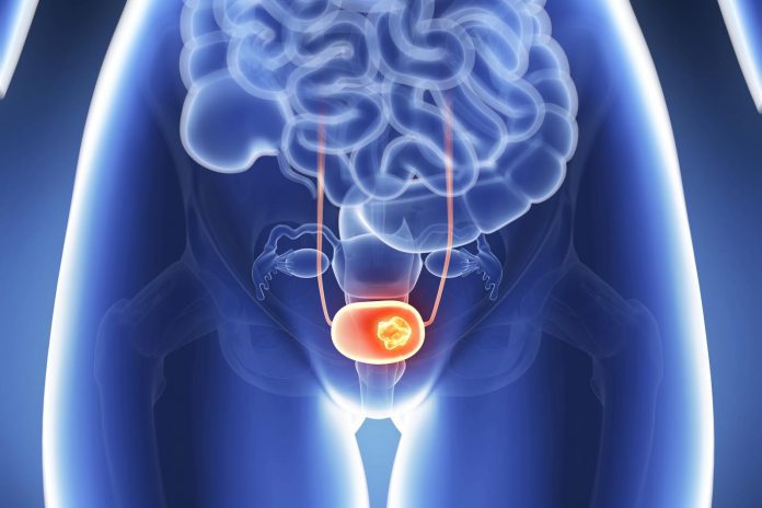 Microbioma e tumori genitourinari: nuove prospettive di cura Microbioma e tumori genitourinari: nuove prospettive di cura