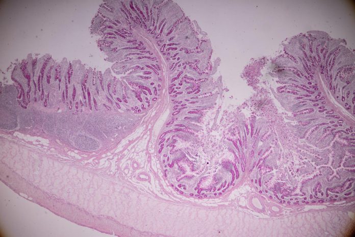Un modello murino migliore per la malattia di Crohn Un modello murino migliore per la malattia di Crohn
