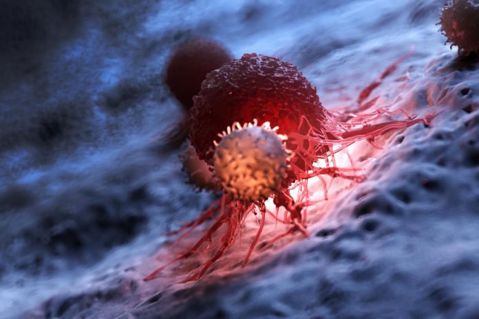 Oncologia: trapianto di microbiota potrebbe evitare la colite da inibitori del checkpoint immunitario Oncologia: trapianto di microbiota potrebbe evitare la colite da inibitori del checkpoint immunitario