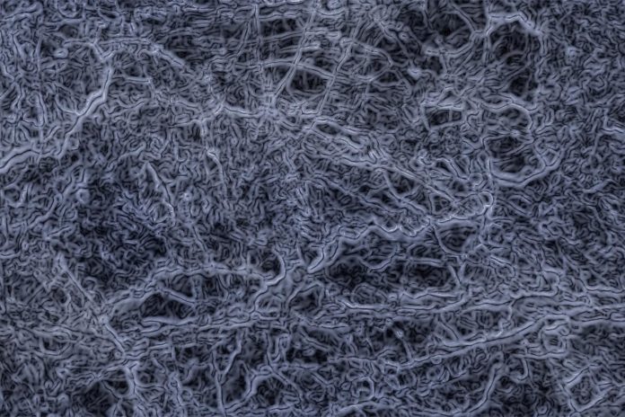 IBD: allo studio probiotici contro i biofilm polimicrobici IBD: allo studio probiotici contro i biofilm polimicrobici