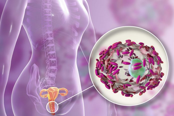 Vaginoma alterato in presenza di infezioni ginecologiche: nuove prospettive per screening e terapie Vaginoma alterato in presenza di infezioni ginecologiche: nuove prospettive per screening e terapie