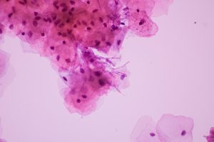 Trapianto del microbiota vaginale: possibile nuova cura per la vaginosi batterica