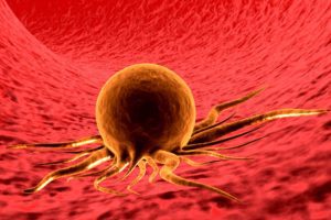 Screening tumore del colon: primi passi verso associazione test immunochimico e microbiota intestinale