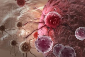 Tumore al colon-retto: dai biofilm batterici nuovi possibili approcci terapeutici