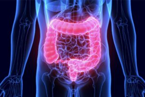 Sanguinamento intestinale: epcidina modifica il microbiota e favorisce la riparazione della mucosa